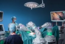 ماذا-سيقدم-الذكاء-الاصطناعي-للبشر-في-المستقبل؟.-منها-الجراحة-الروبوتية